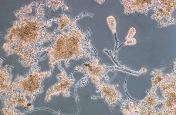 Mikroskopische Aufnahme von Bakterien